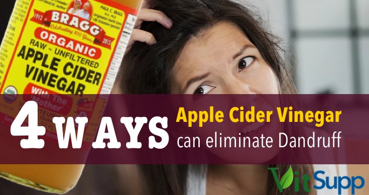 eliminate dandruff with apple cider vinegar