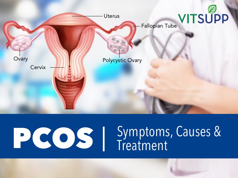 PCOS Polycystic Ovary Syndrome Symptoms, Causes and Treatment