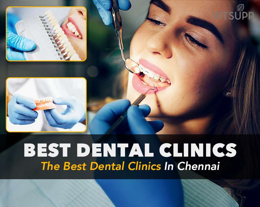 The best Dental clinics in Chennai