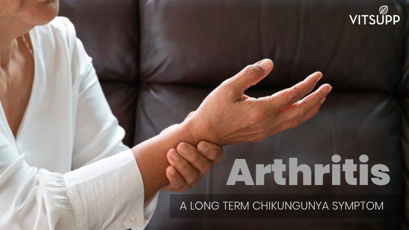 Arthritis - A long term chikungunya symptom