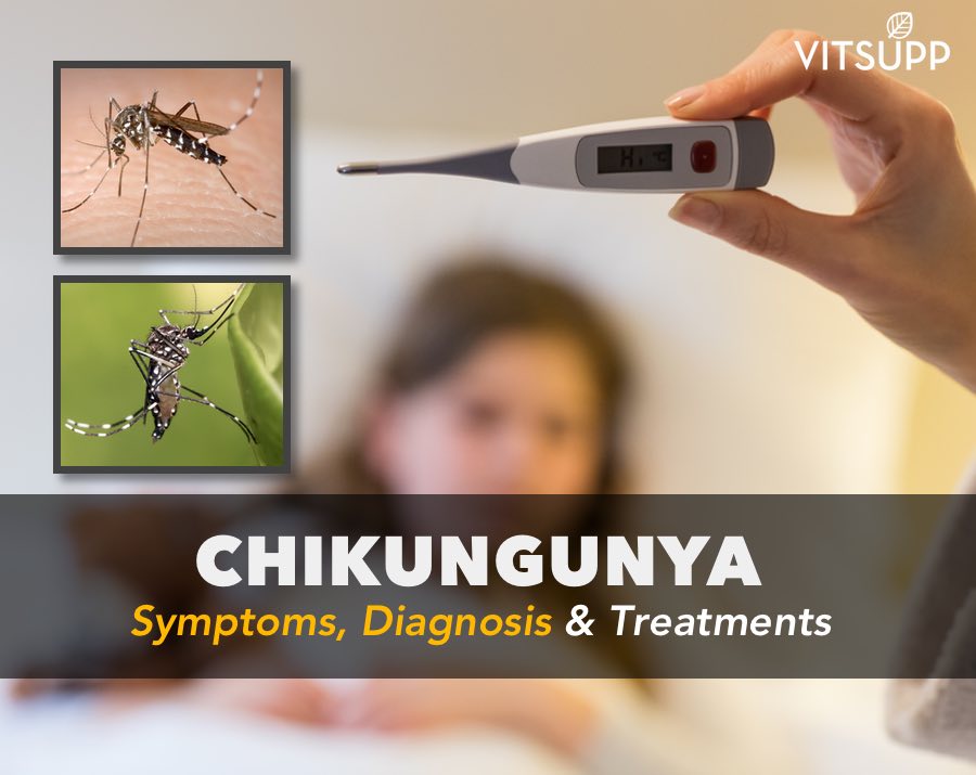 chikungunya - symptoms diagnosis & treatment