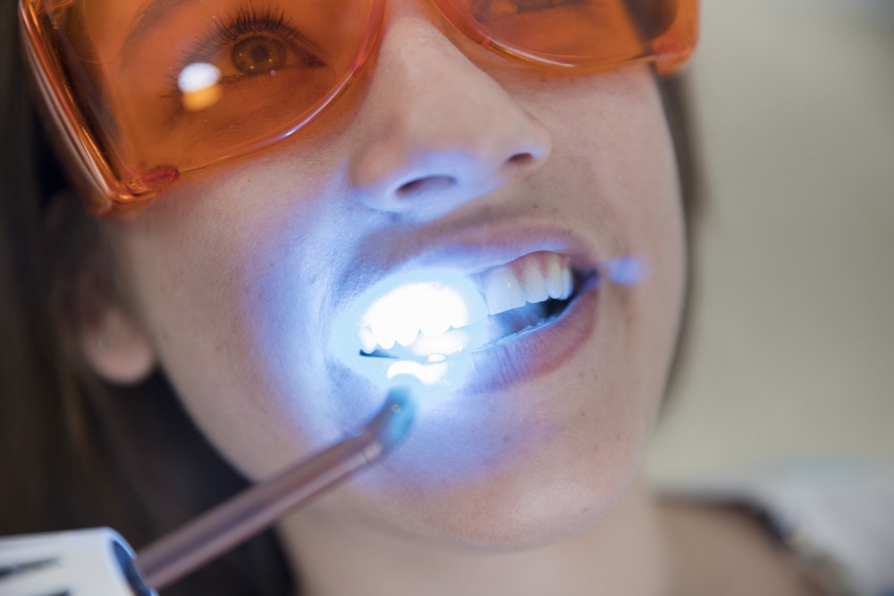 best laser dental clinic chennai tamil nadu india