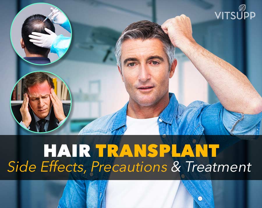 Hair Transplant Side Effects in Long Term & Short Term | VitSupp Hair Transplant Side Effects in Long Term & Short Term | VitSupp