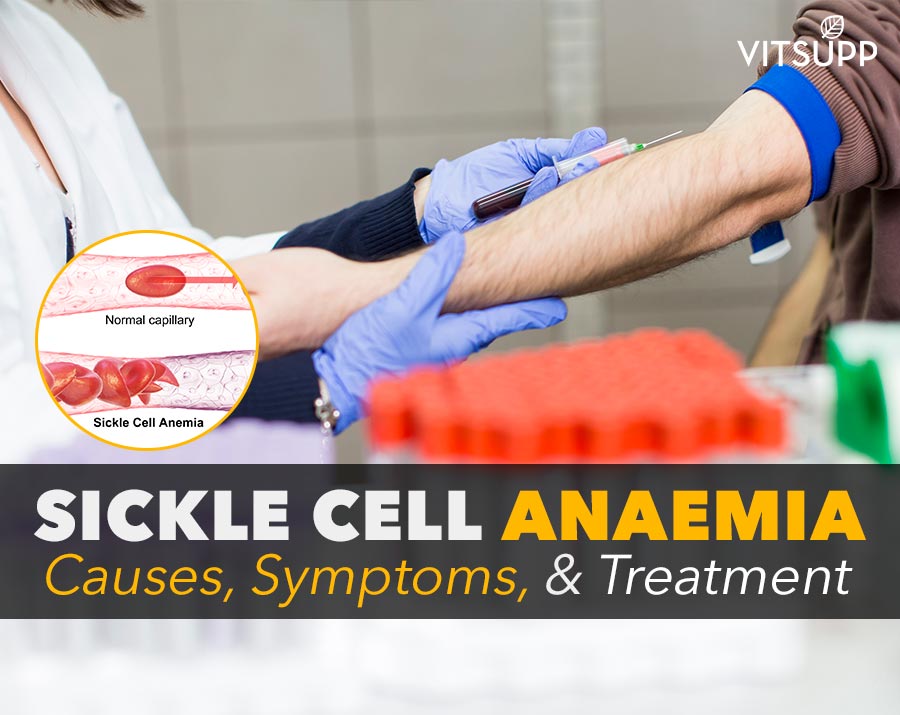 causes of sickle cell anaemia shows