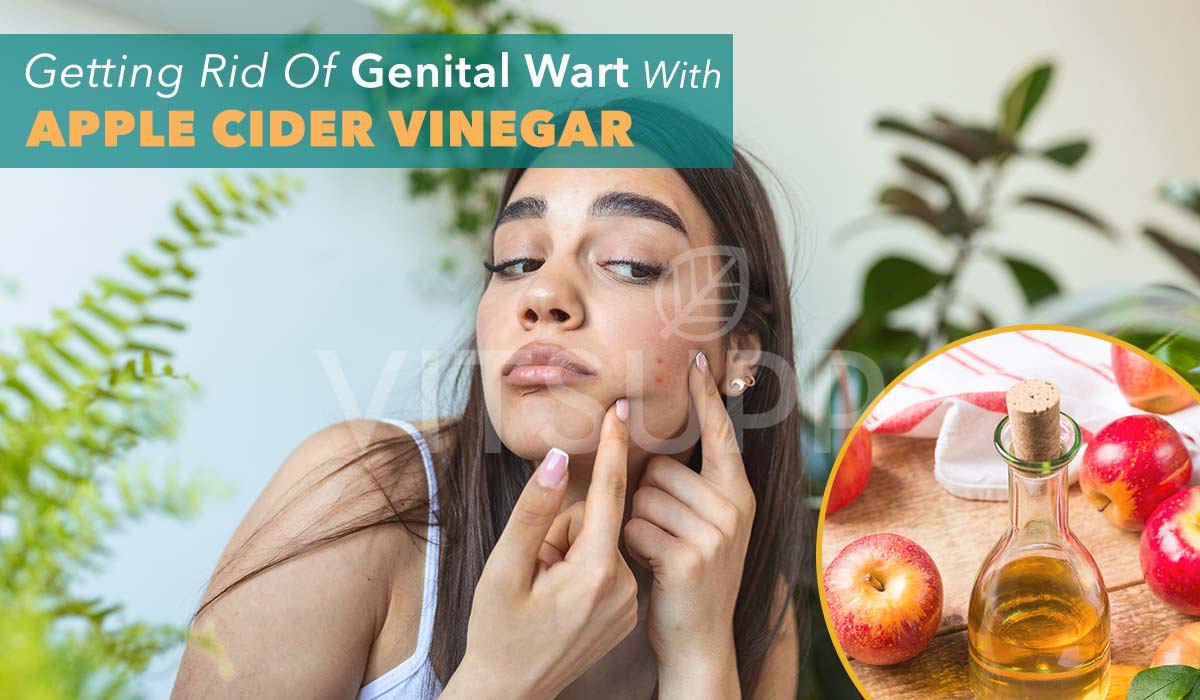 Getting rid of genital warts with apple cider vinegar