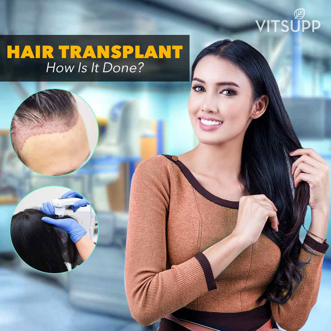 How is Hair Transplant done