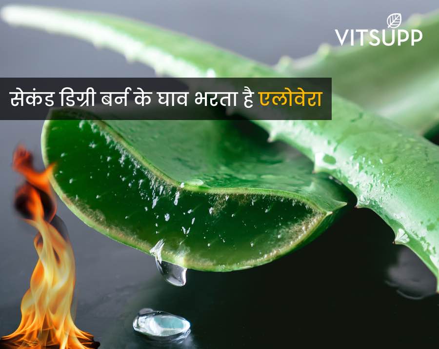aloe vera ke fayde skin ke liye